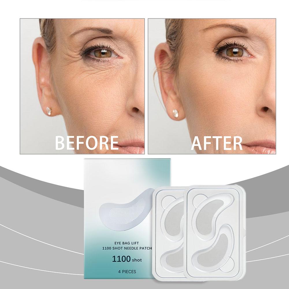 Hyaluronic Acid Microneedle Ey - Microneedle Patch Eye recension och pris